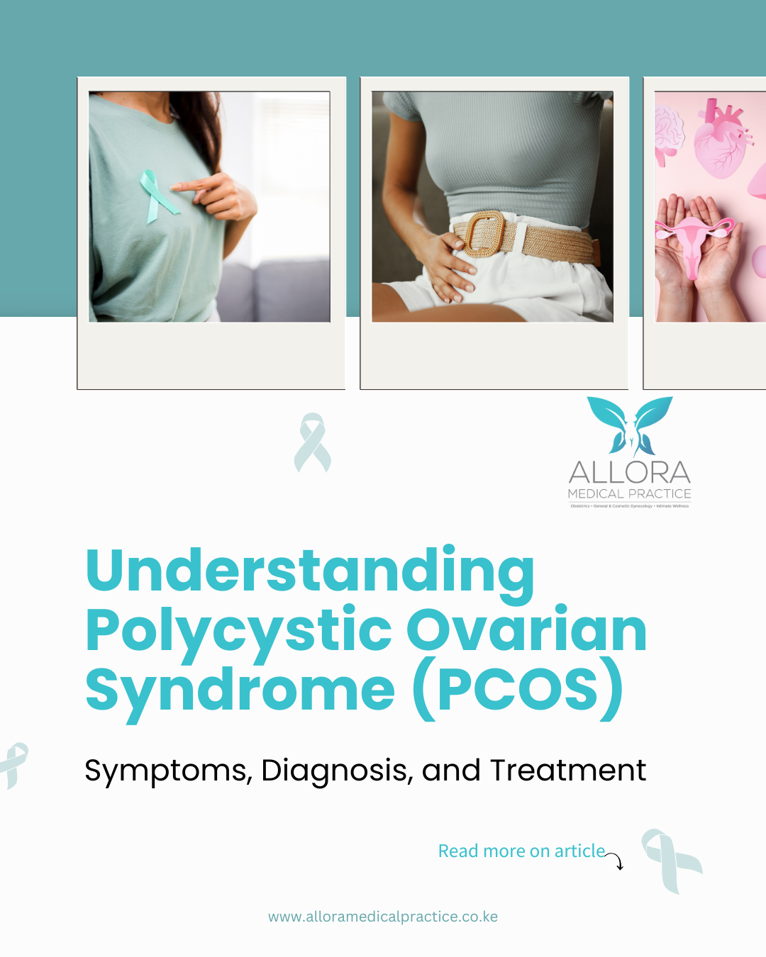 What is PCOS? A Complete Guide to Polycystic Ovary SyndromeUnderstanding Polycystic Ovarian Syndrome